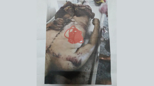Una lunga linea di cicatrici sul corpo di Lü Zhonghua