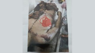 Una lunga linea di cicatrici sul corpo di Lü Zhonghua