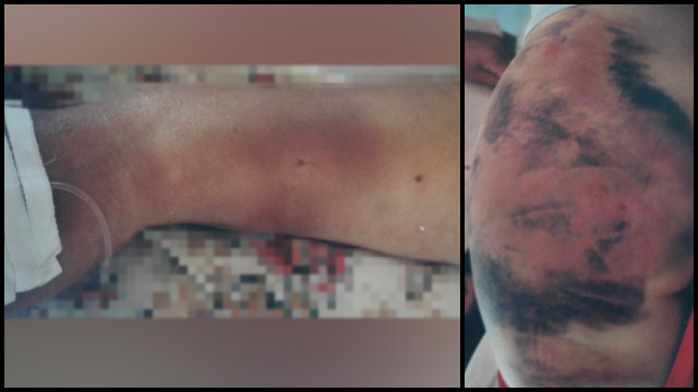 Li Yi è stata picchiata con violenza